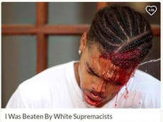 Black protester ‘beaten with metal poles’ by white supremacists