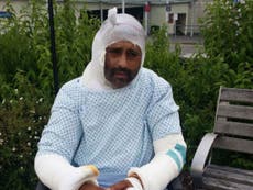 Acid attack victim Jameel Mukhtar says ‘whole life is finished’