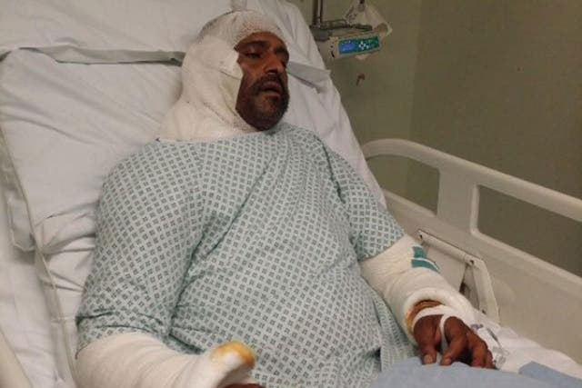 Jameel Muhktar, 37, in hospital following an acid attack on 21 June