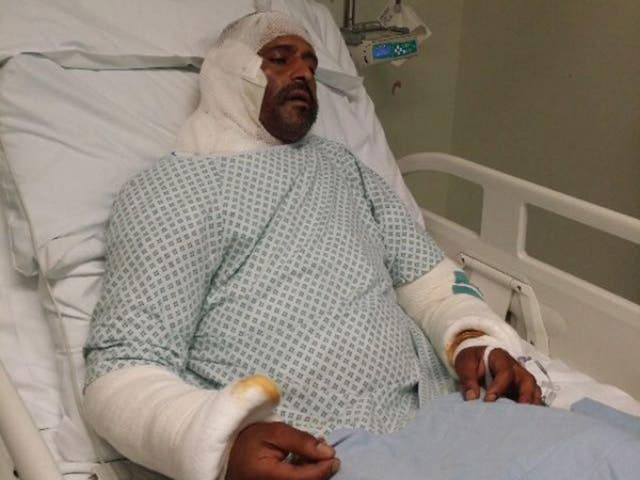 Jameel Muhktar, 37, in hospital following an acid attack on 21 June