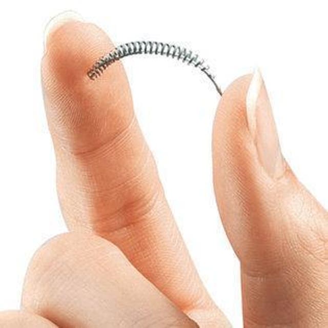 The Essure birth control implant