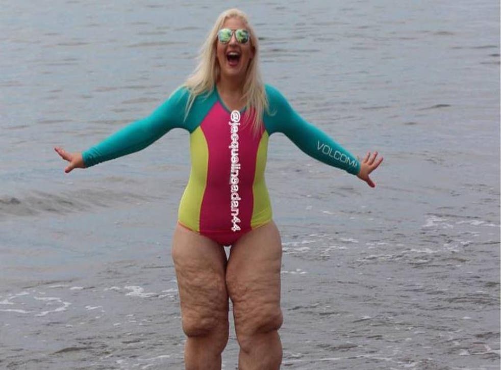 A Woman Who Lost 25 Stone Has The Perfect Response To Being Fat Shamed Indy100 Indy100 A Woman Who Lost 25 Stone Has The Perfect Response To Being Fat Shamed Indy100 Indy100