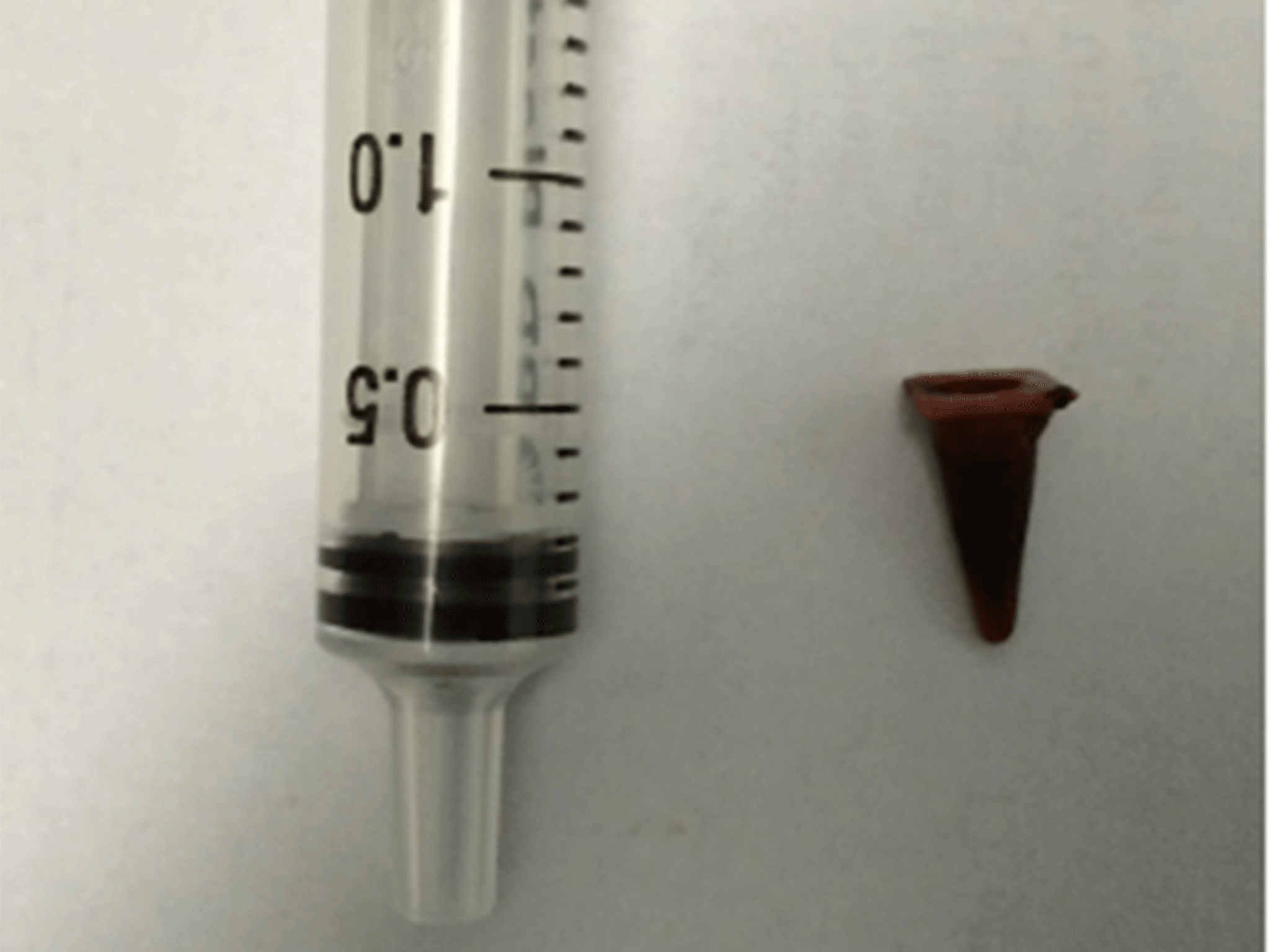 Man discovers mass in his lung is not cancer but small toy cone 