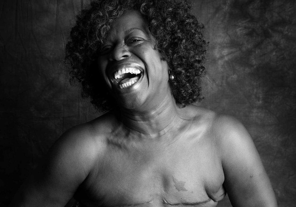 Stand Up To Cancer launches powerful campaign of women showing their mastectomy  scars, The Independent