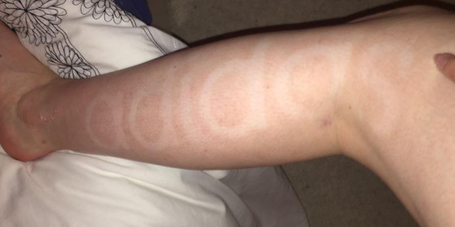 This Woman Applied Fake Tan Before The Gym And Showed The World Why That S A Terrible Idea Indy100