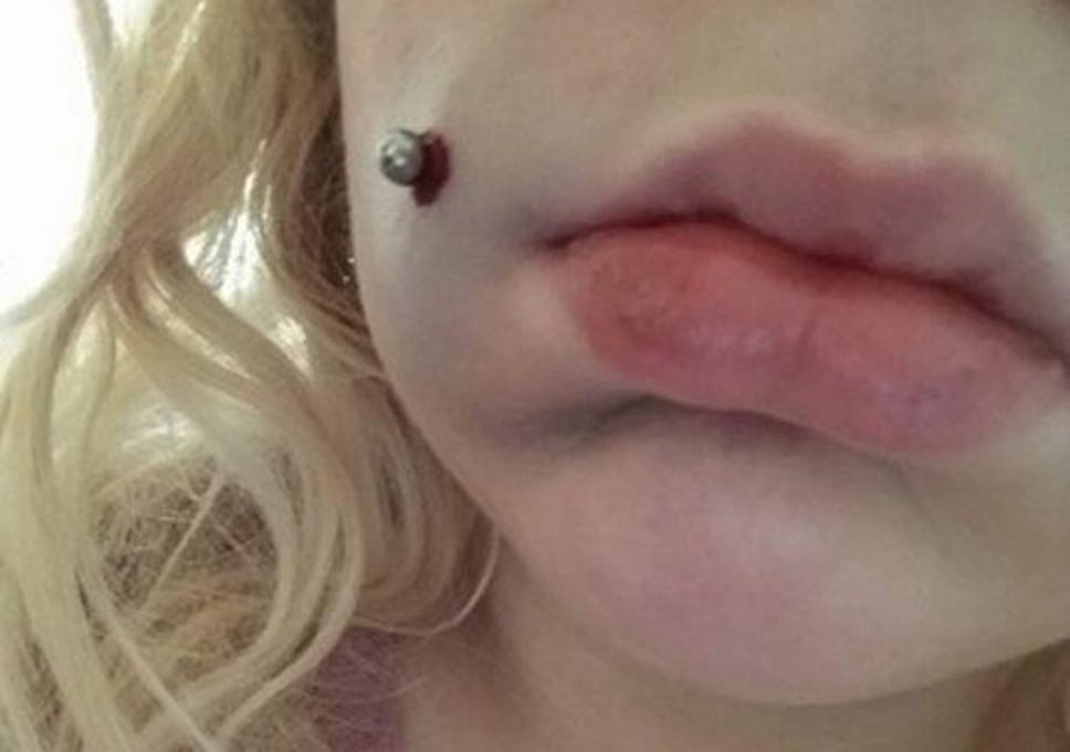 Woman Tells Of Botched Piercing That Left Her Mouth Bleeding