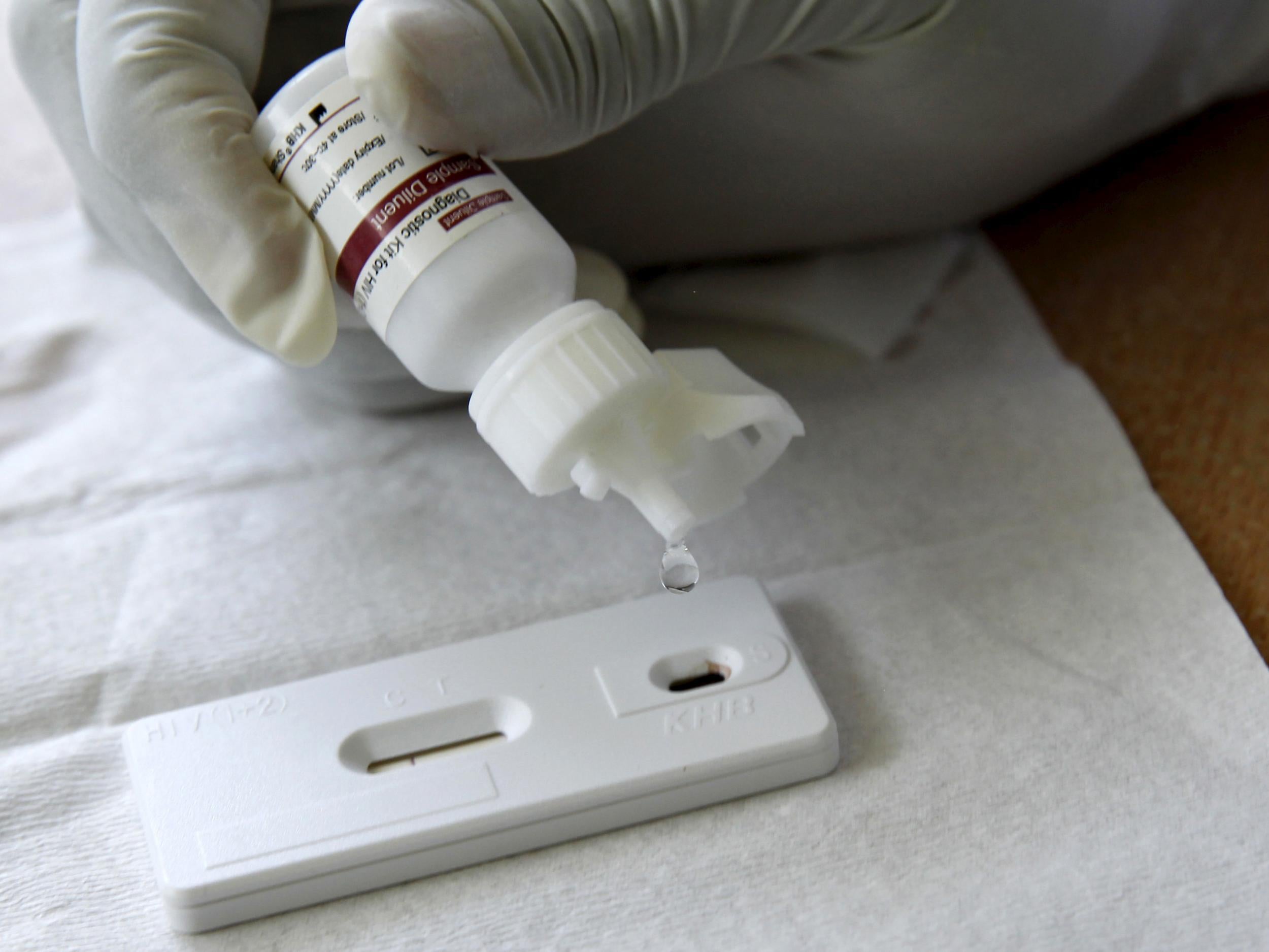 File photo: A reactor is added to a blood sample to test for HIV