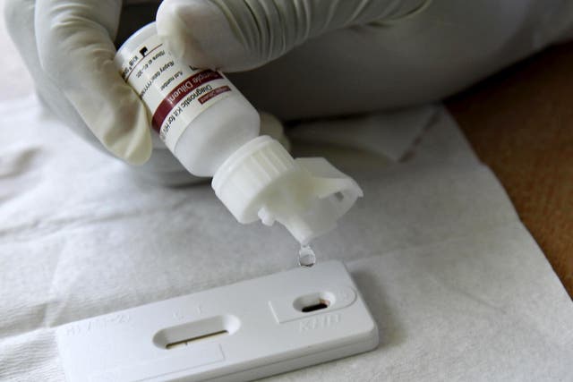 File photo: A reactor is added to a blood sample to test for HIV