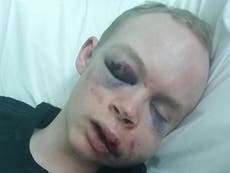 Police release image of Londoner beaten up in 'unprovoked' attack