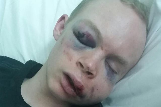 The 22-year-old was left with horrific injuries following an attack in central London