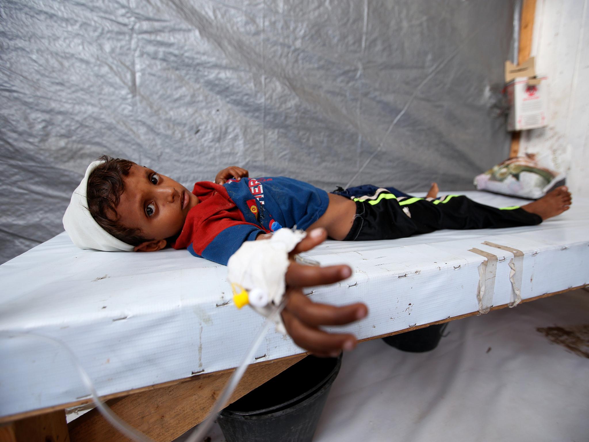 A child victim of cholera in Yemen