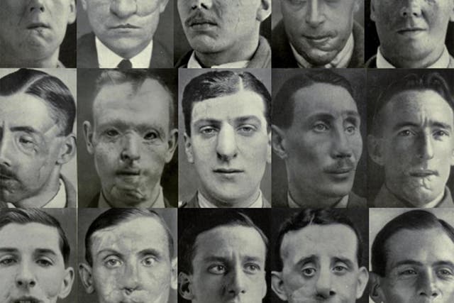 Images from ‘Plastic Surgery of the Face’ by Sir Harold Gillies, 1920