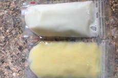 Mother is shocked when her breastmilk turns yellow, then finds out why