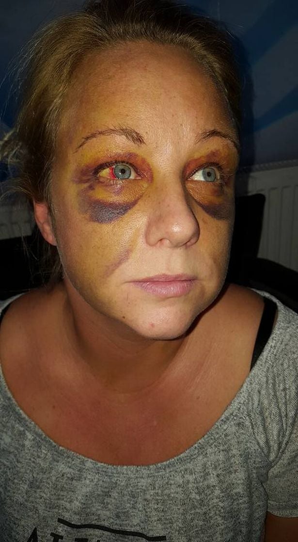 Sarah Wheatley, 37, has bravely spoken about her ordeal