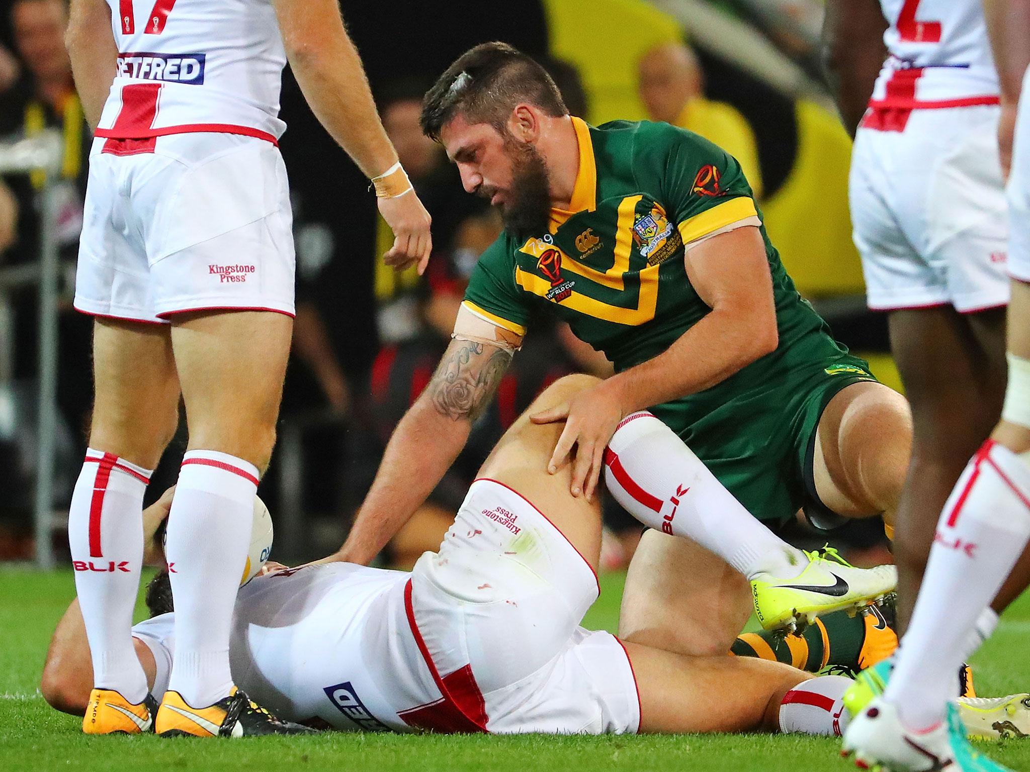 Burgess picked up the injury 35 minutes into the match against Australia