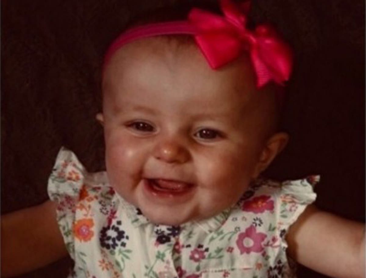 Donations pour in for family of baby girl suffering 'worst case' of ...