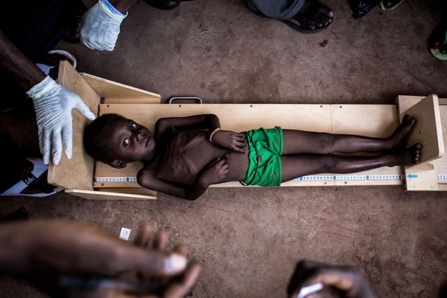 A child is measured in a clinic treating cases of severe malnourishment in Tshikapa, Kasai