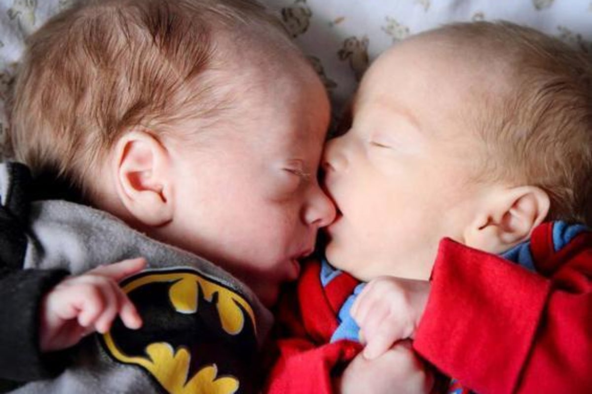 Identical twins cheated death in the womb by hugging each other | The  Independent | The Independent