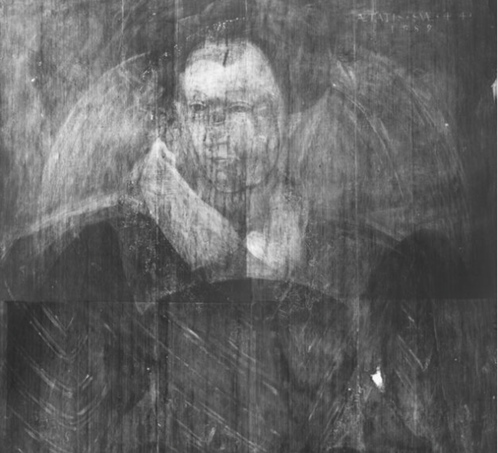 X-rays were limited in that they could only produce a black-and-white image