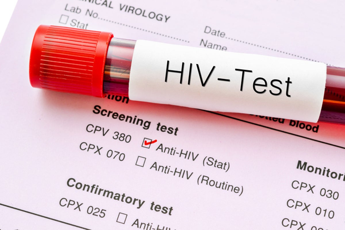 HIV rates rise in Northern Ireland – despite falling across rest of UK ...