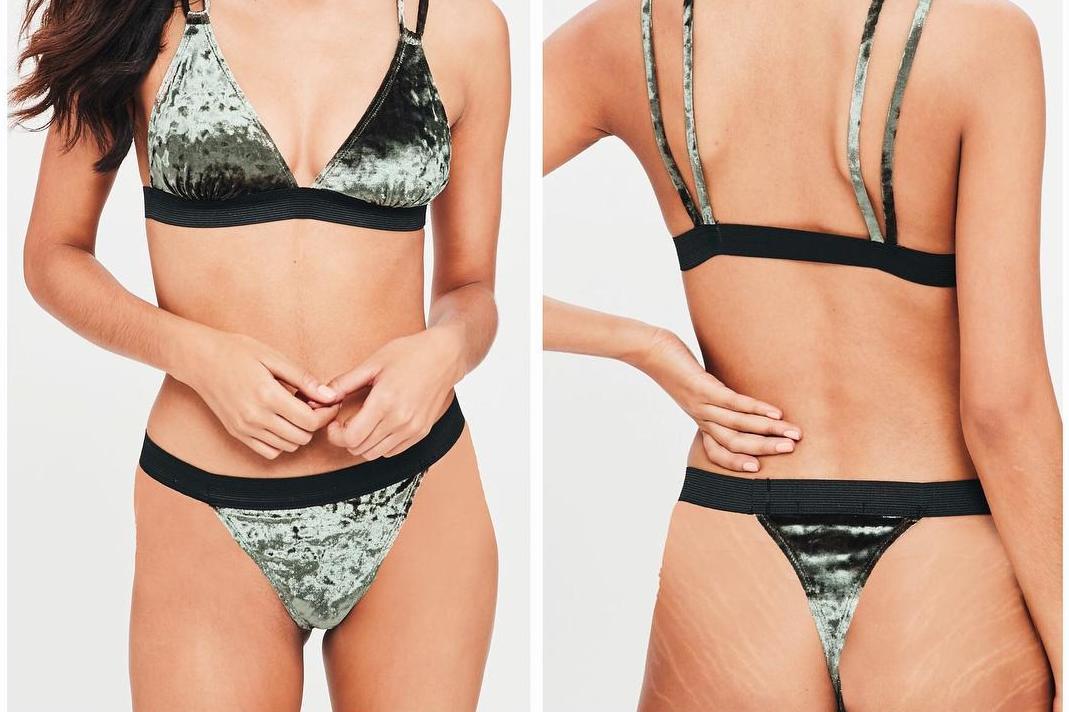 Missguided accused of digitally imposing stretch marks on model s