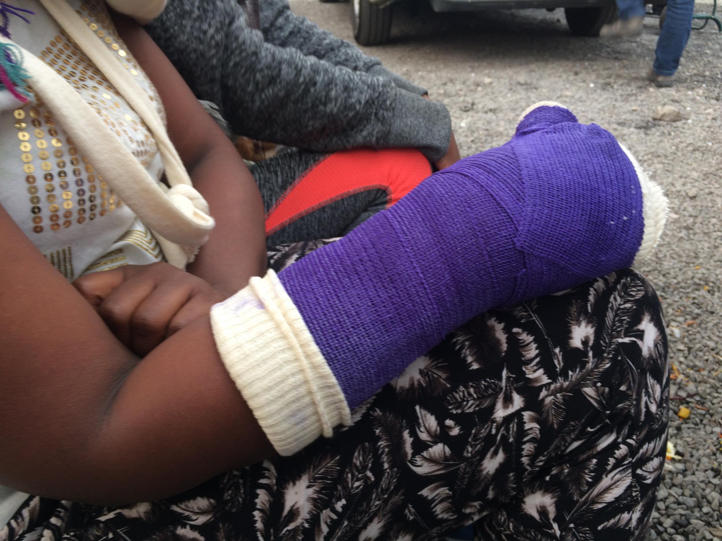Mercy, 28, broke her arm after falling over while being chased from a lorry by police