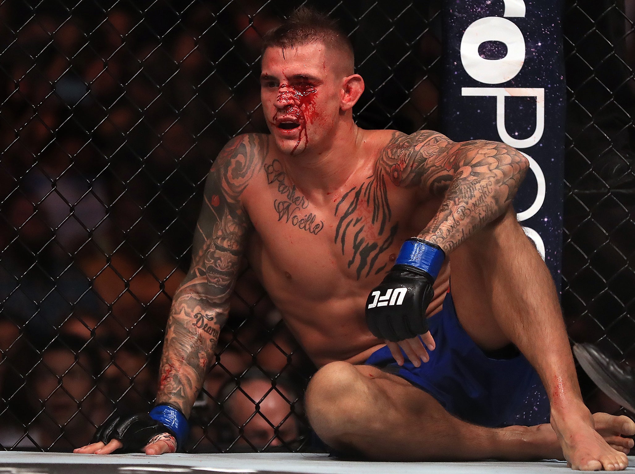 Poirier's last fight was ruled a No Contest