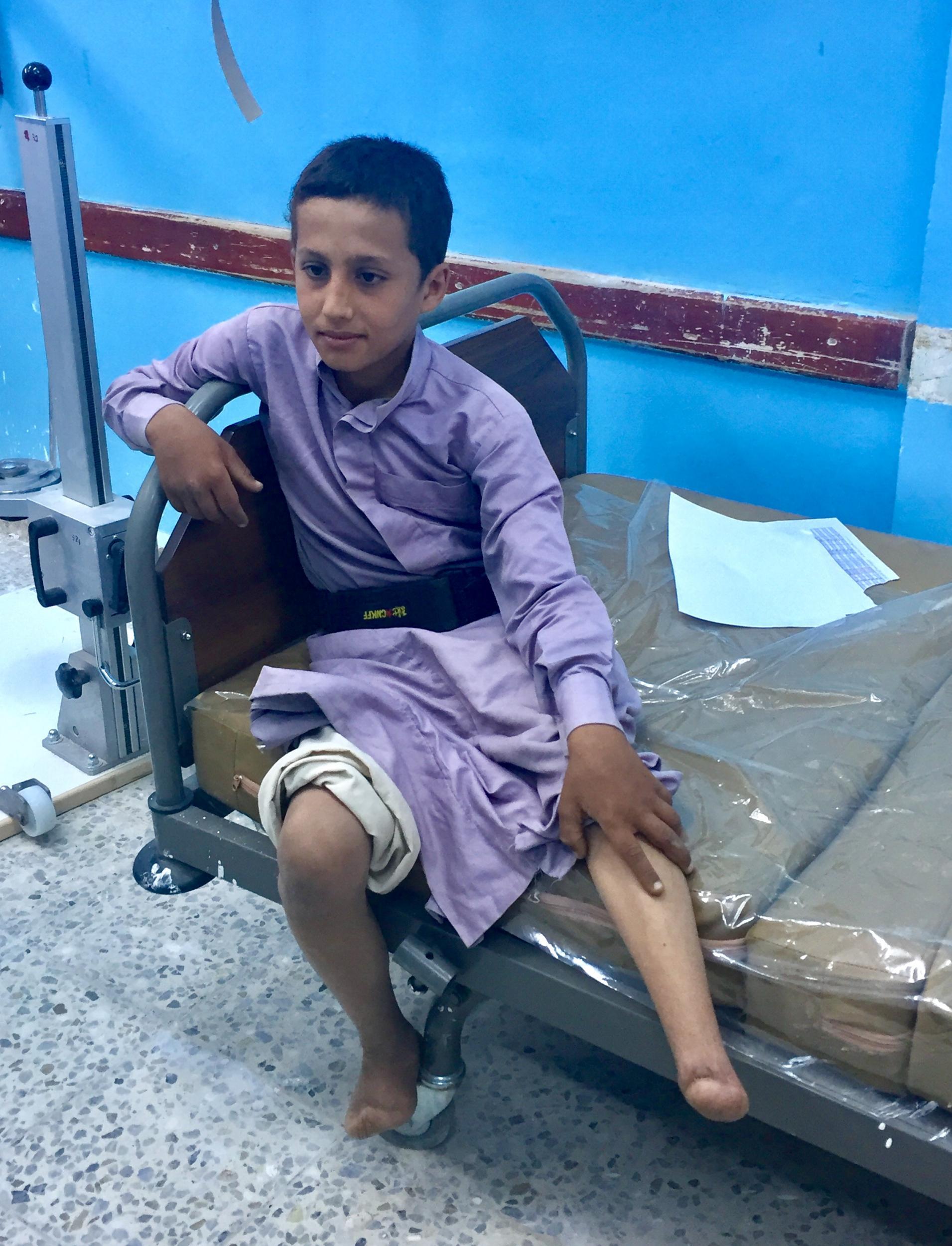 A boy who lost his left leg to a landmine is examined by a doctor at Marib General Hospital. Up to 16 people a week have been admitted needing amputations in recent months, hospital authorities said