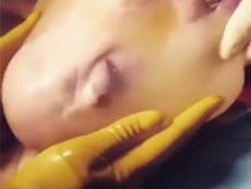 Video captures rare moment baby born inside amniotic sac