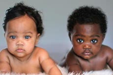 Twin babies with different skin colours are now Instagram stars