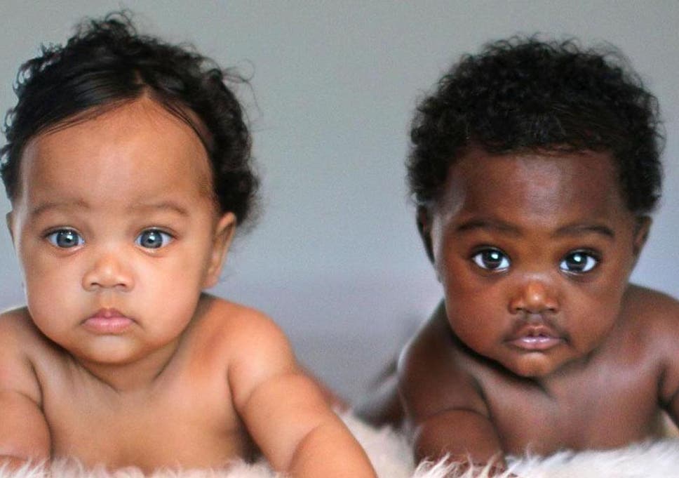 Image result for African identical twins, babies