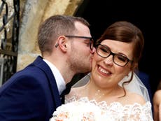 Woman born with severe facial deformity weds after 18 operations