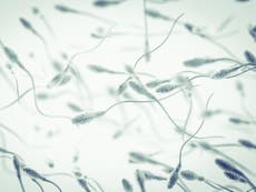 Dying man with brain injury has sperm extracted