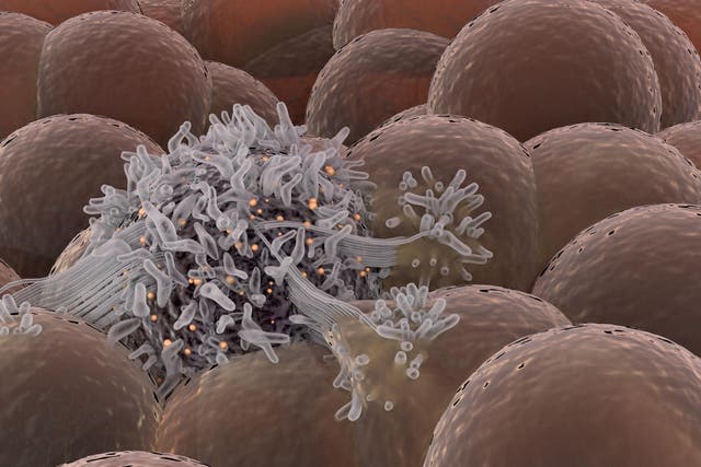 Cancer cell spreading among healthy cell stem cells