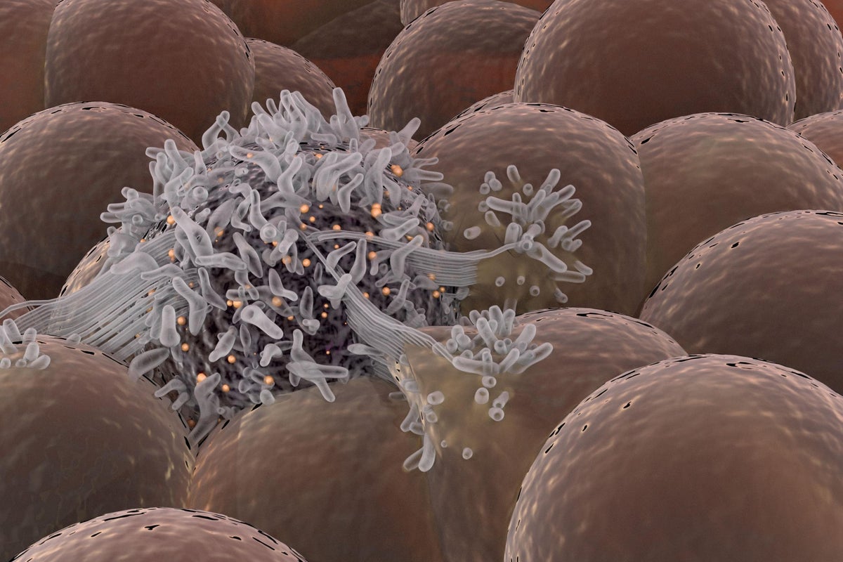 Rogue 'cell of origin' may trigger every type of cancer, research ...