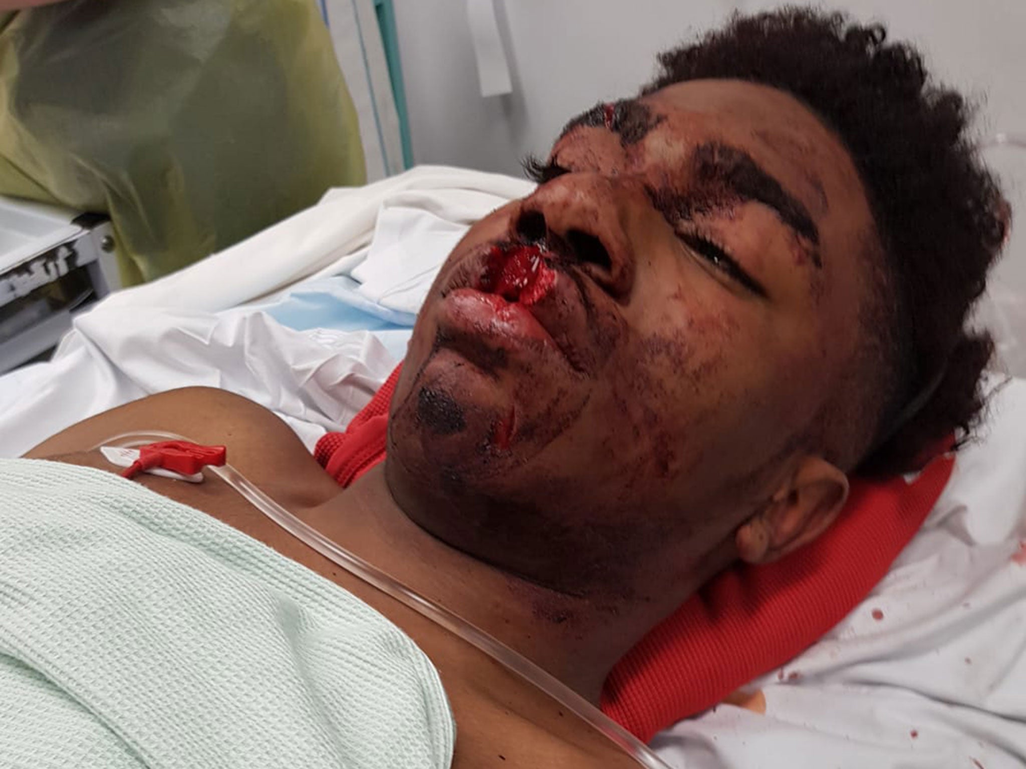 Terrell Decosta Jones-Burton, 15, was injured while being detained by the Metropolitan Police on 21 November