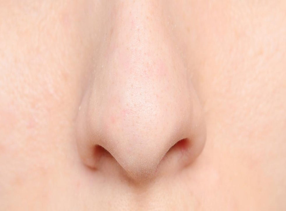 Those blackheads on your nose are probably something else altogether