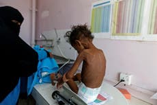 First aid arrives in Yemen after ease of blockade amid famine warnings