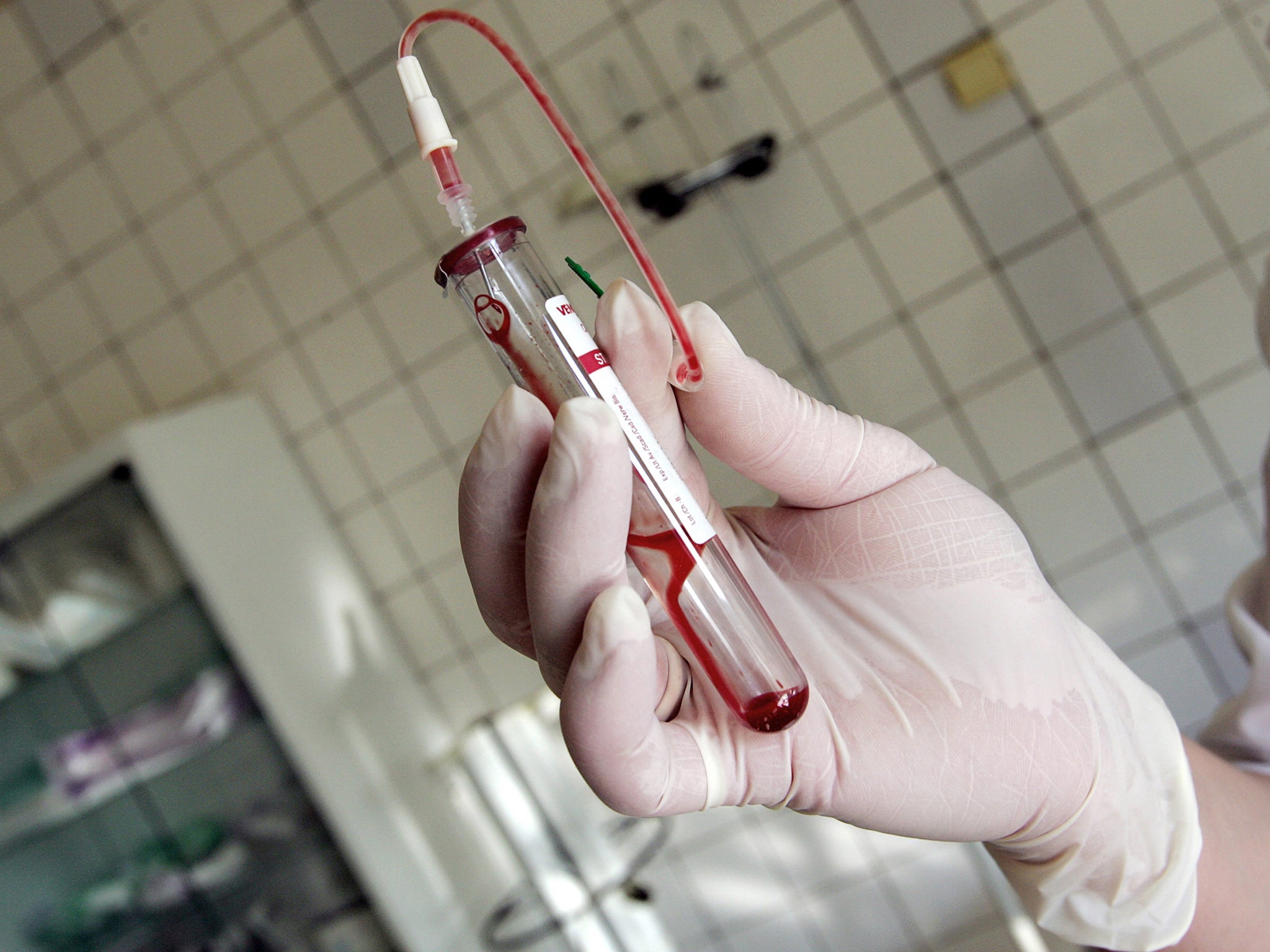 A test-tube with HIV positive blood in an infectious diseases hospital in Moscow (AFP/Getty )