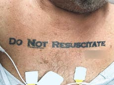 Patient with 'do no resuscitate' tattoo confuses doctors