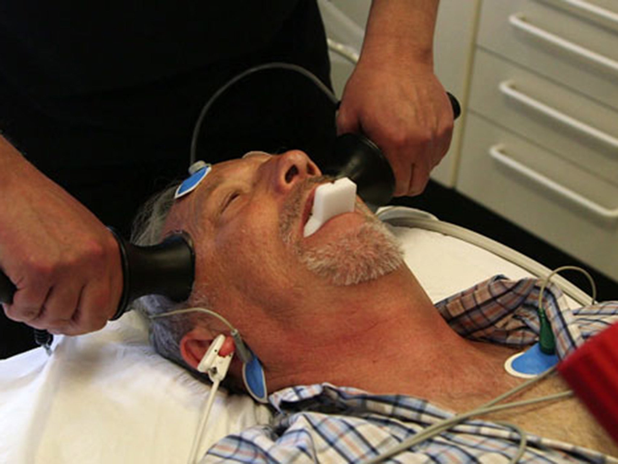 A patient receives electric shock therapy in the UK in 2013