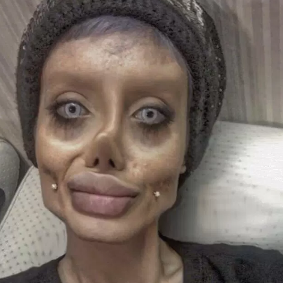 Teen behind viral Angelina Jolie plastic surgery photos reveals