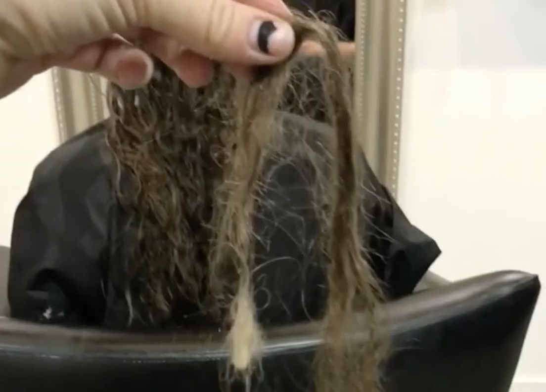 Hairdresser Reveals Shocking Extent Of Postpartum Hair Loss Faced