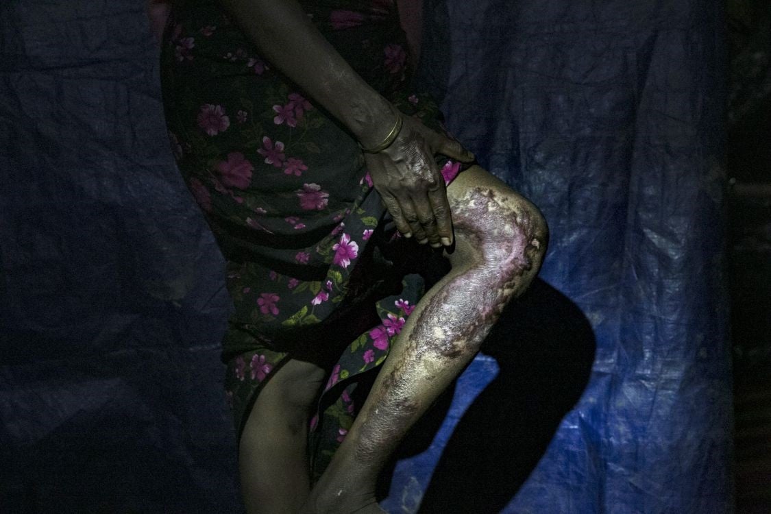 Mumtaz escaped a burning house set on fire by the military