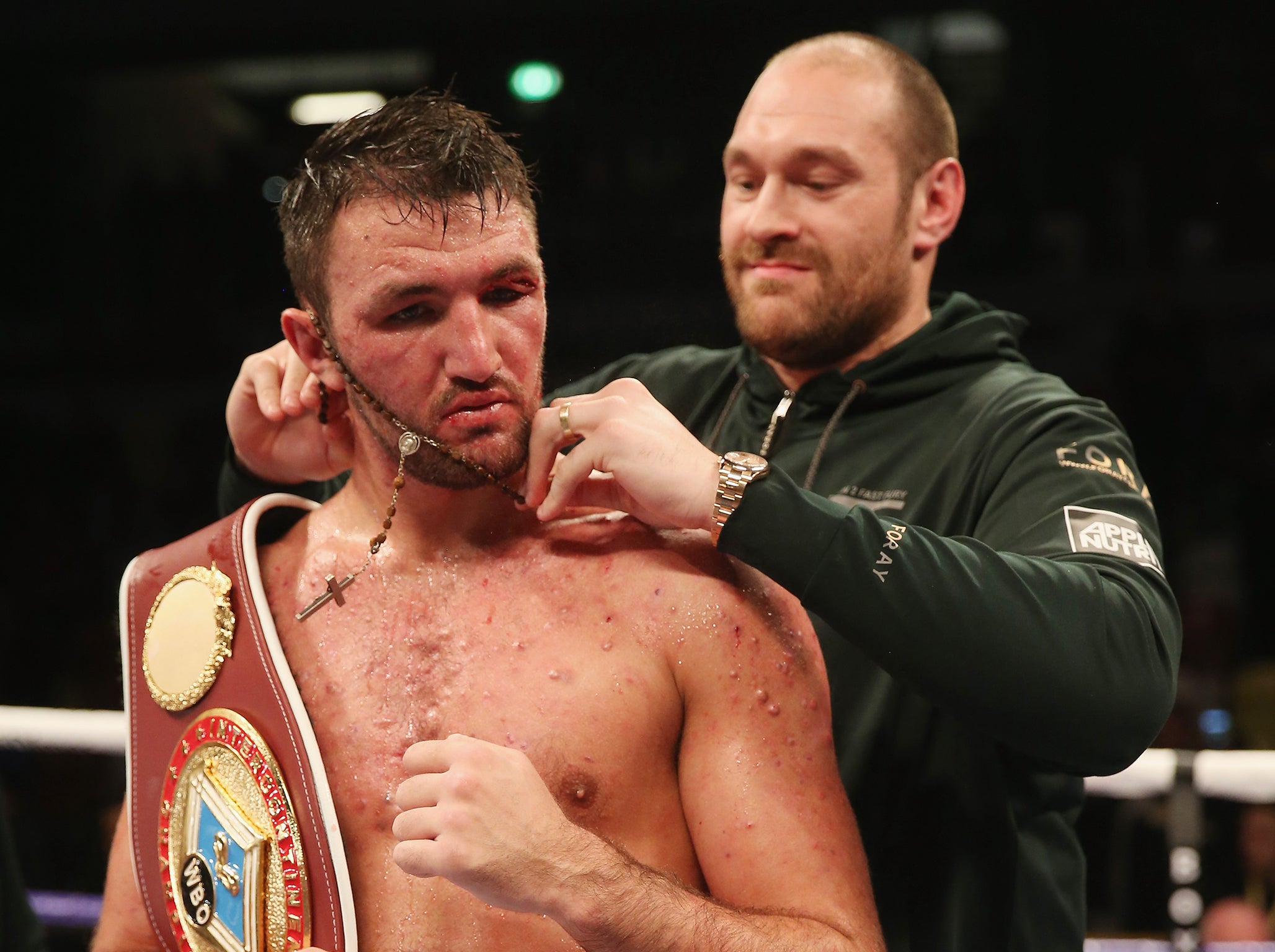 Hughie Fury suffered from acne conglobata