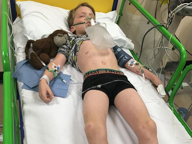 Now, Oliver's parents are calling for all children to be vaccinated