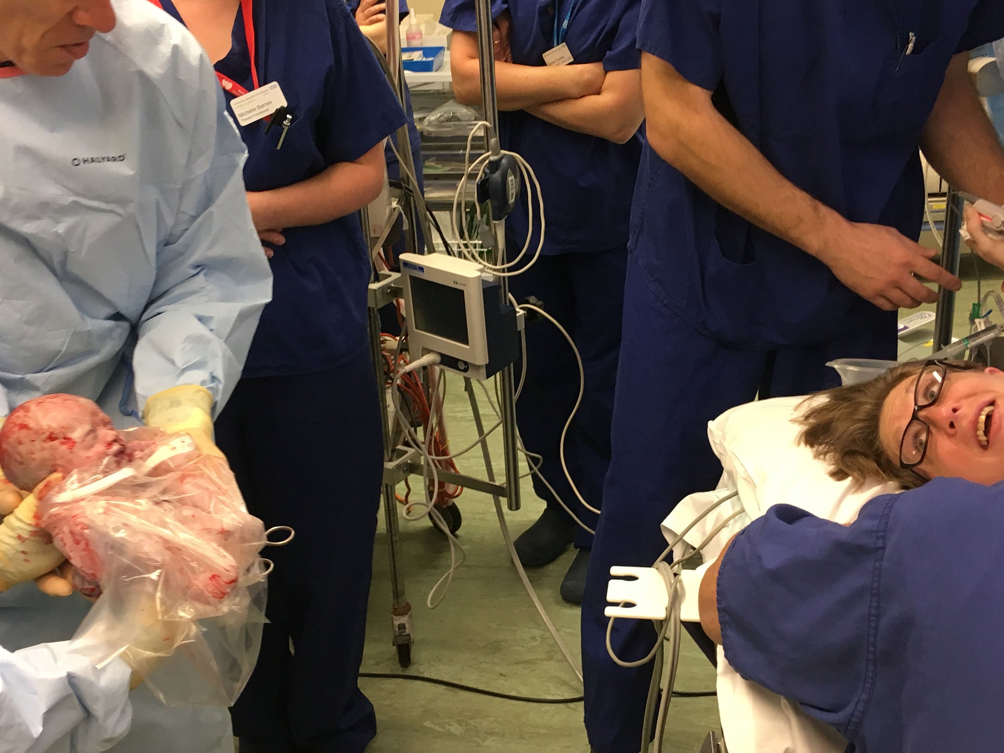 Girl born with heart outside her body survives surgery in UK first ...