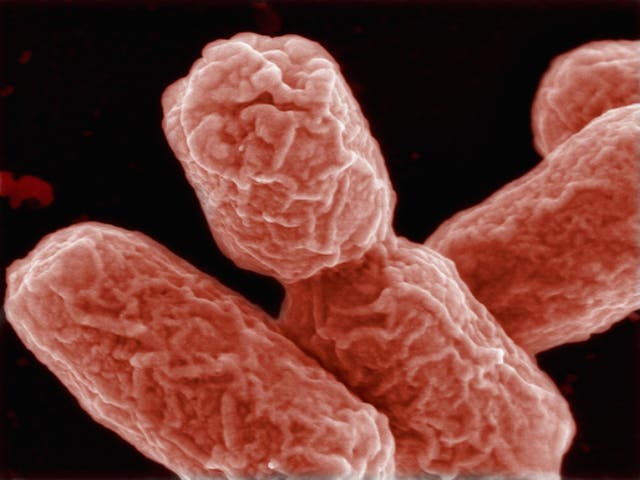 Bacteria like E coli have a vulnerability in their outer layer that could be targeted with new medication