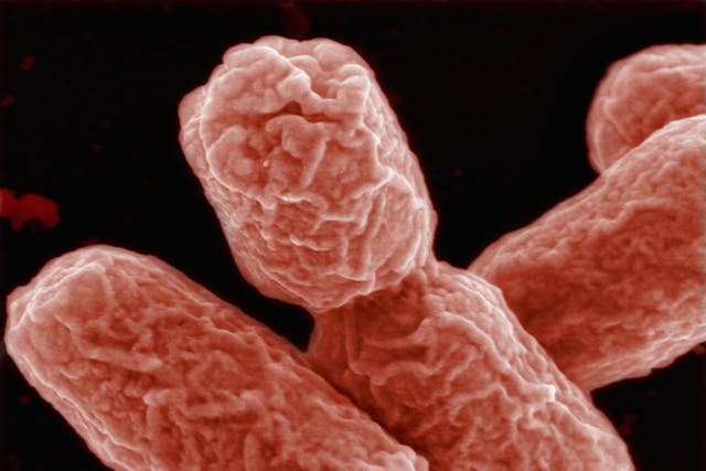 In this handout photo provided by the Helmholtz Center for Research on Infectious Diseases an EHEC bacteria is visible on May 30, 2011 in Berlin, Germany