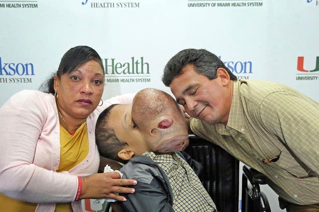 The tumour is benign, but could kill the Cuban teenager if left untreated